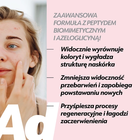 Serum na przebarwienia potrądzikowe